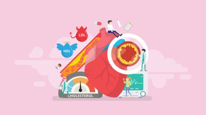 Как нормализовать уровень холестерина?