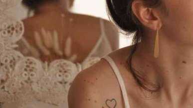 Страшно ли удалять родинки?